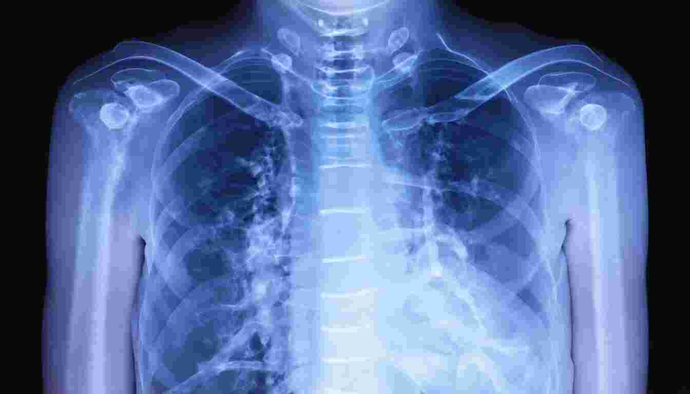 Interpretation of chest X-rays in foreign body aspiration and lower respiratory tract infections, including the significance of the thymic shadow in pediatric imaging