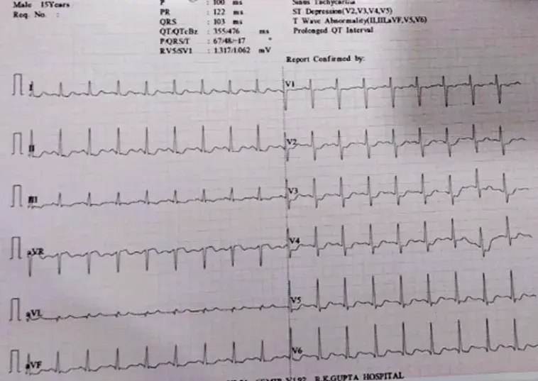 15-Year-Old-Male Found Unconscious in Bathroom