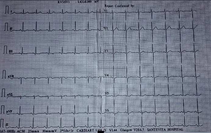 Puzzle: 42-Yr.-Old Male Patient with Left Sided Chest Pain of 1 Day Duration